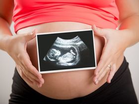Come risarcire la nascita indesiderata